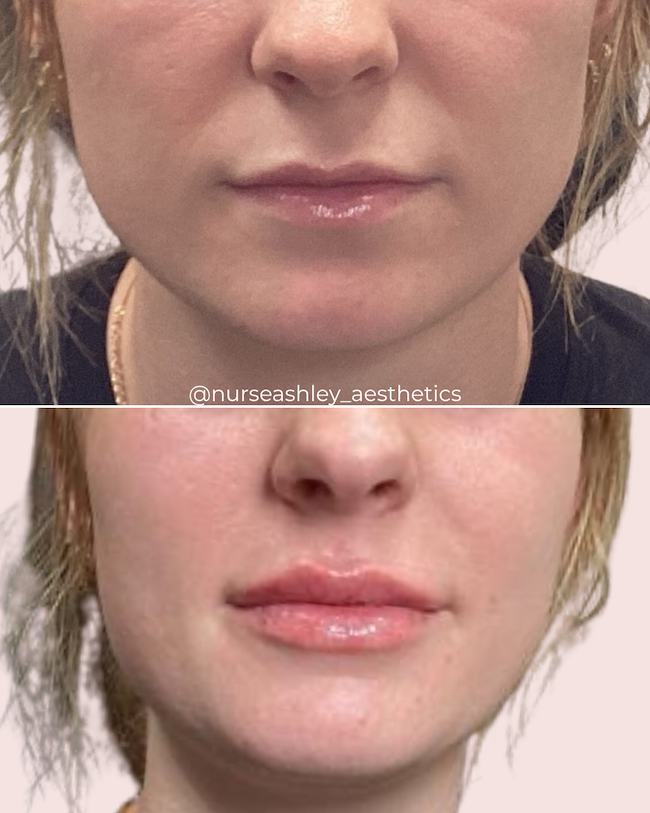 Taylor K lips - 1.png