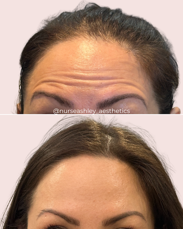 Wrinkle Relaxers