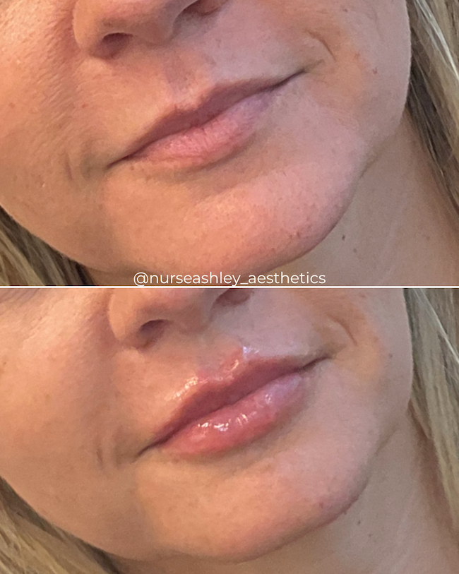Katie Miller lips.png