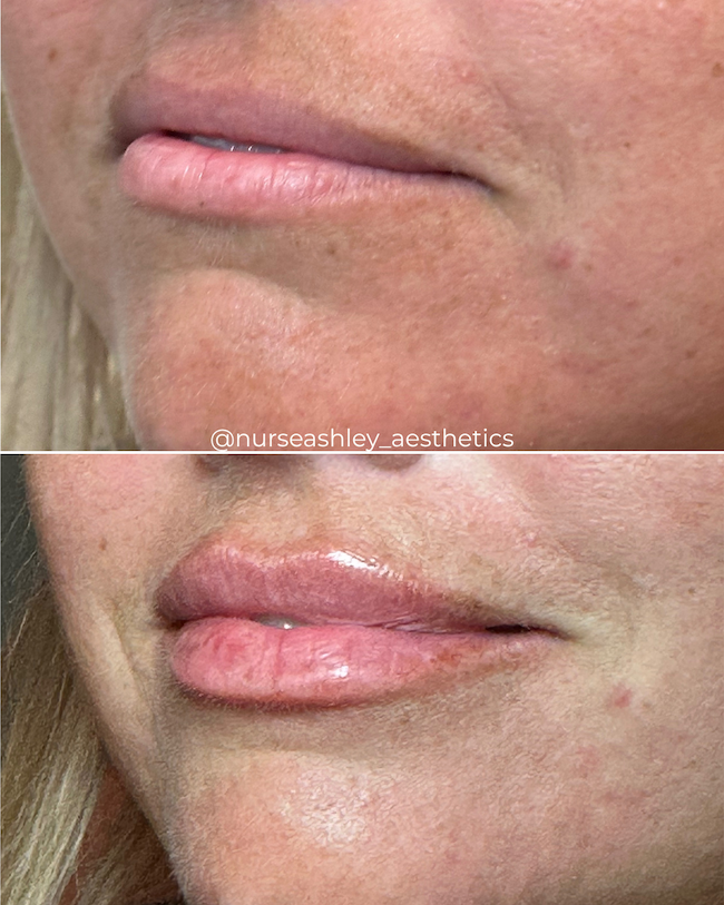 Contest winner lips - 2.png
