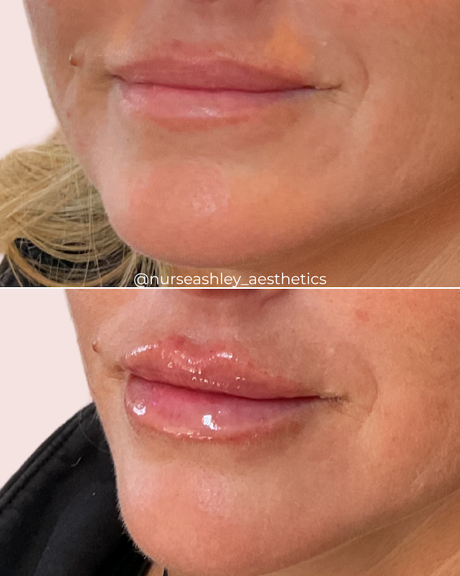 April Garcia lips.png
