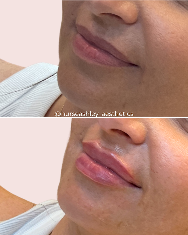 Terra lips.png