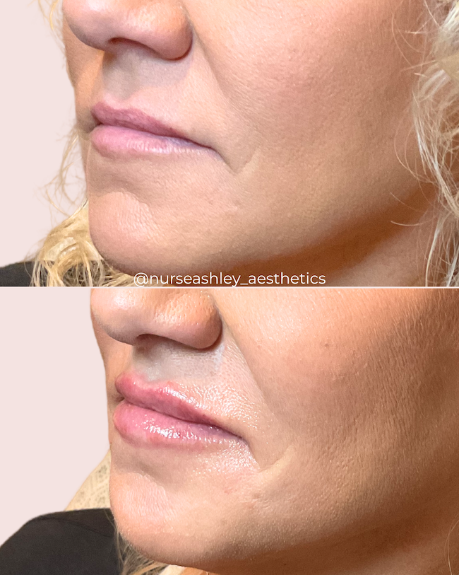 nicki Sammons lips.png