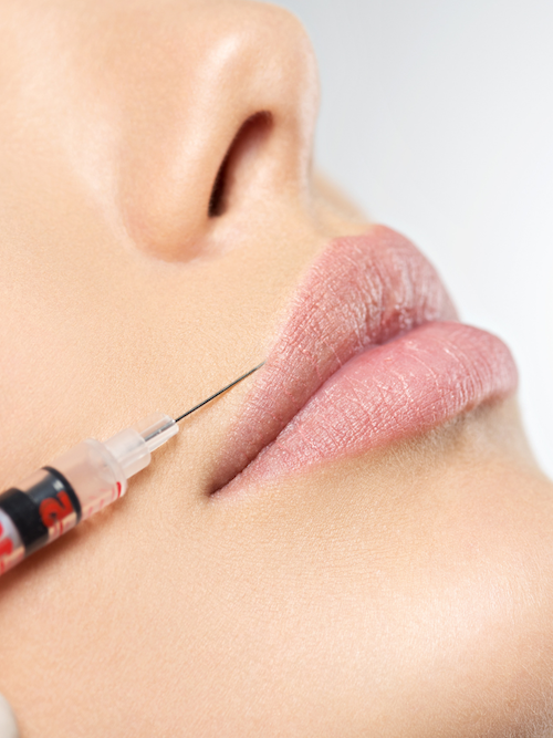 Dermal Fillers