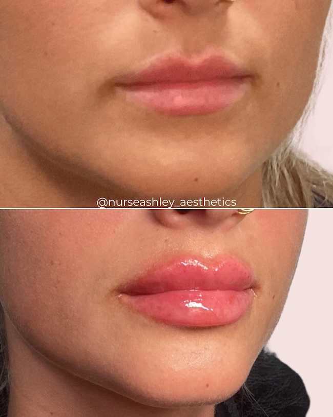 McKenzie Diez lips - 1.png