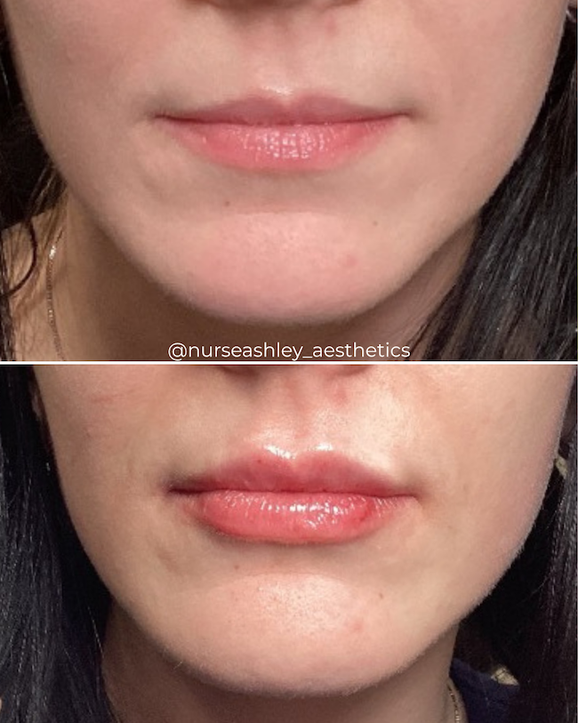 Josie Channell lips - 1.png