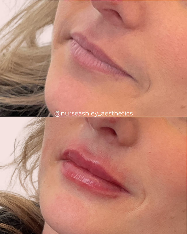 Browtender lips Feb 2025.png