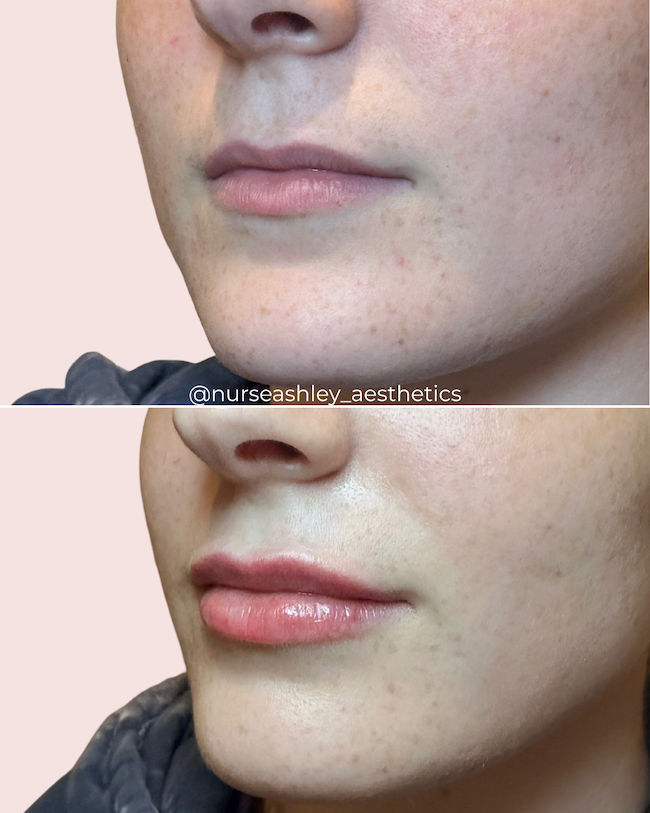 Kaitlin brown lips  - 1.png