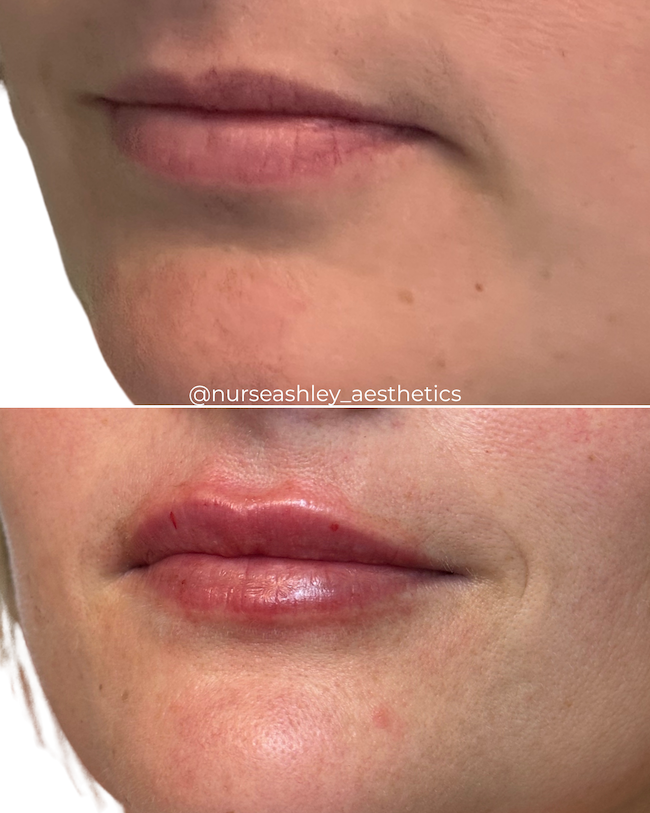 Kara boatman lips.png