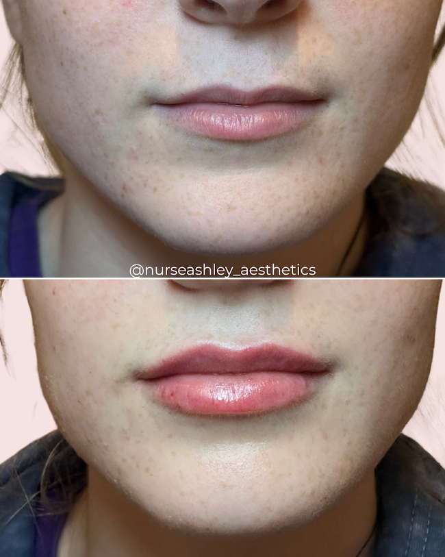 Kaitlin brown lips  - 2.png