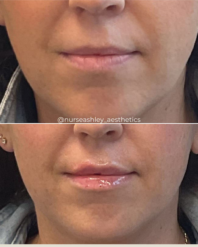 carlee chavis lips cheeks - 1.png