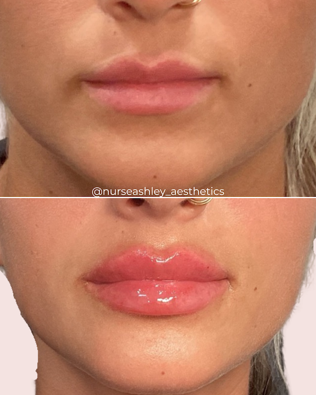 McKenzie Diez lips - 2.png