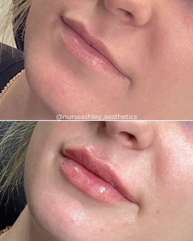 Taylor K lips - 3.png