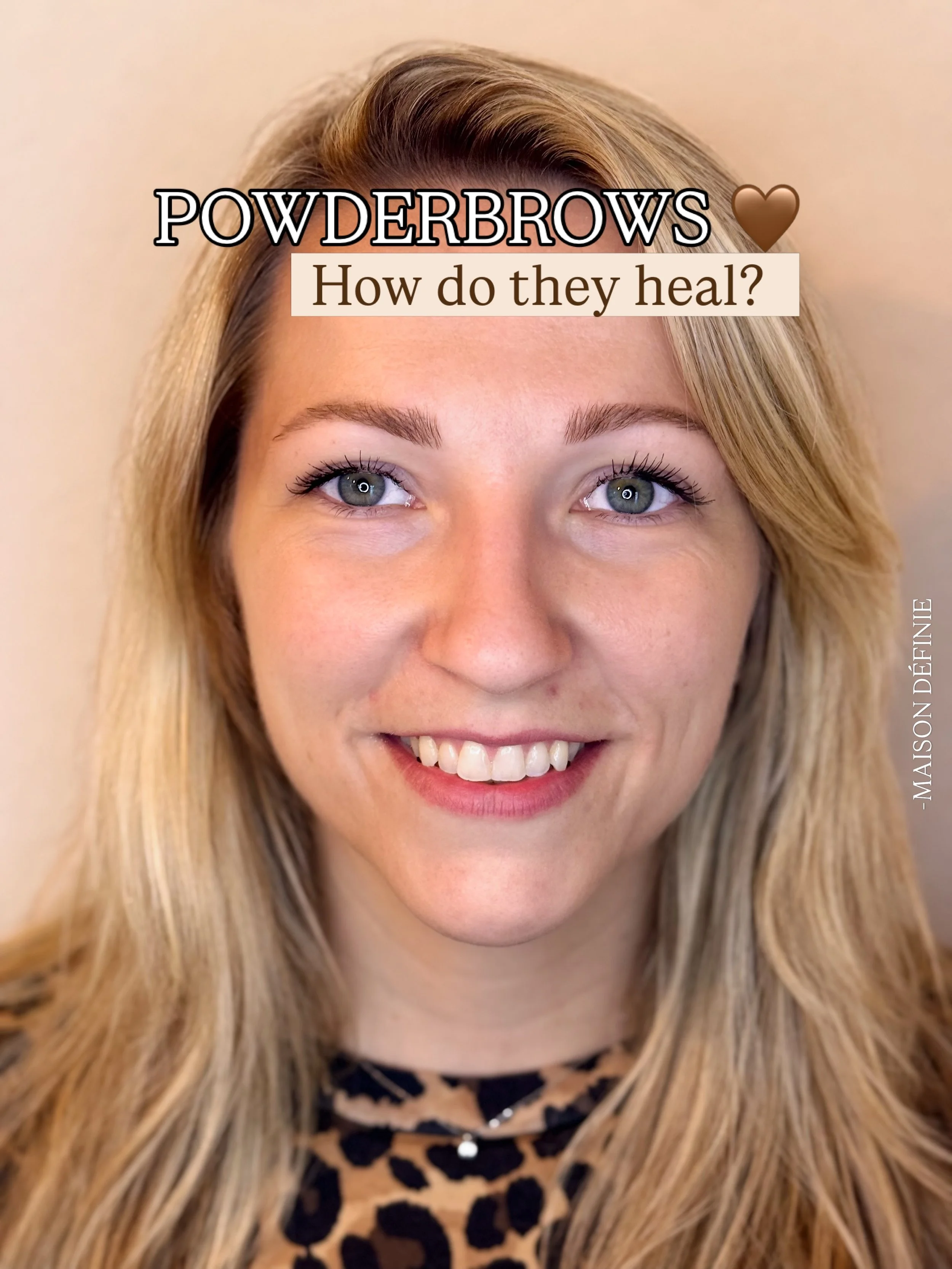 POWDERBROWS 🤎 HEALED RESULTS

&ldquo;Maar worden powderbrows niet heel donker?&rdquo;

Een vraag die ik regelmatig krijg. En heel begrijpelijk, want direct na de behandeling zijn de brows vaak intenser van kleur.

Tijdens het genezen wordt de kleur 