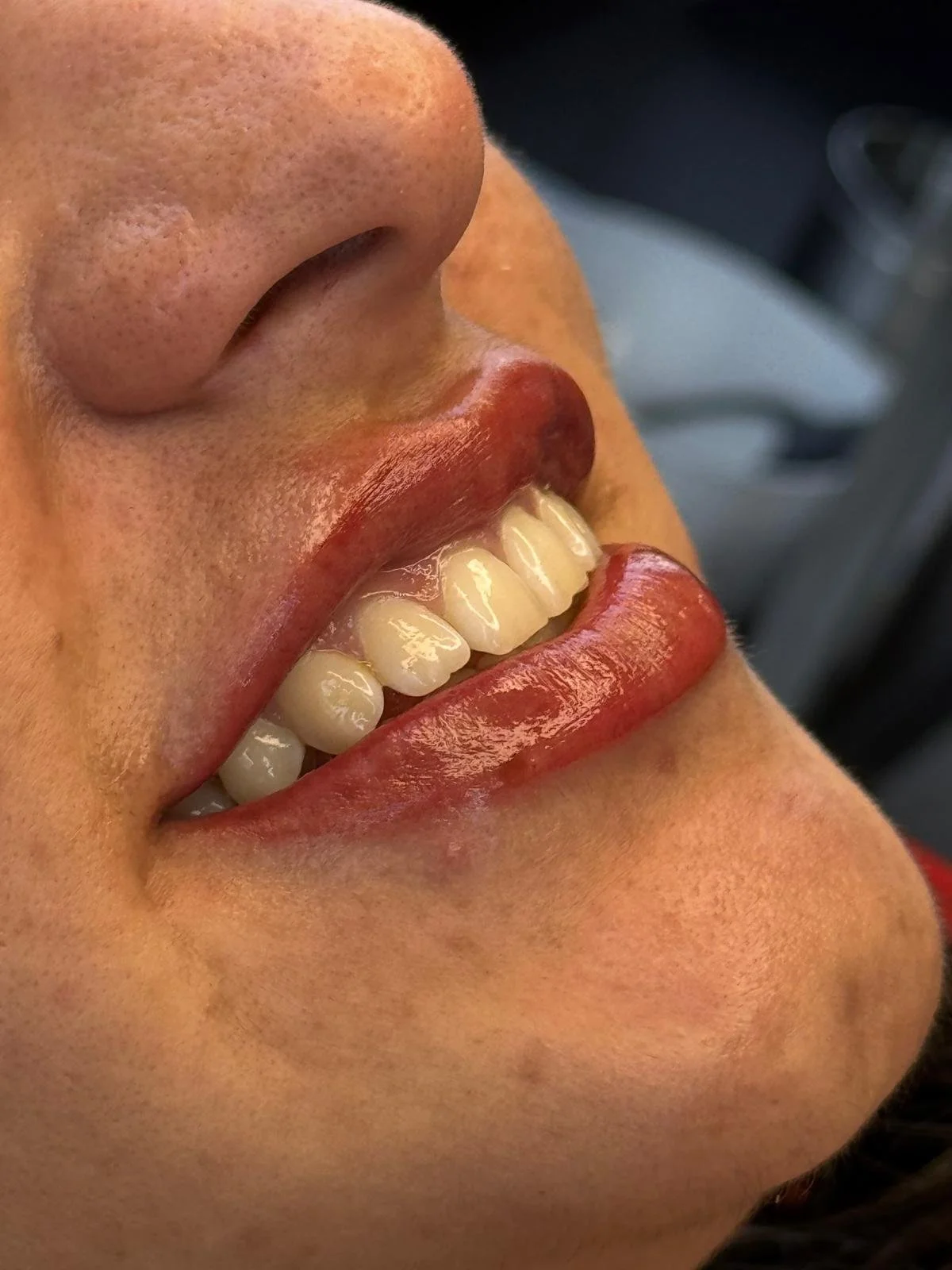 lippen E A2.jpeg