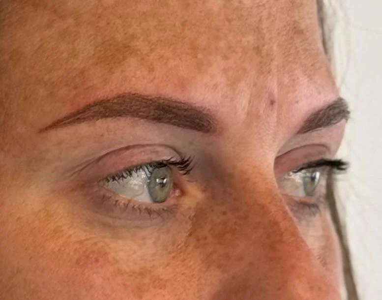 Direct na de behandeling.
De kleur oogt direct na de behandeling intenser. Tijdens de genezing vervaagt de pigmentatie gemiddeld met circa 30-40% en ontstaat een zachter, natuurlijker resultaat.
