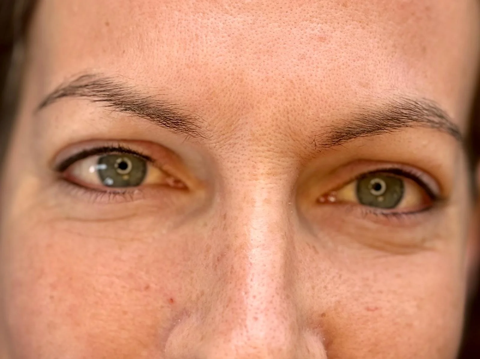 Eyeliner boven, infralash beneden. De eyeliner oogt direct na de behandeling intenser. Tijdens de genezing verzacht de kleur en ontstaat een verfijnd en natuurlijk resultaat.