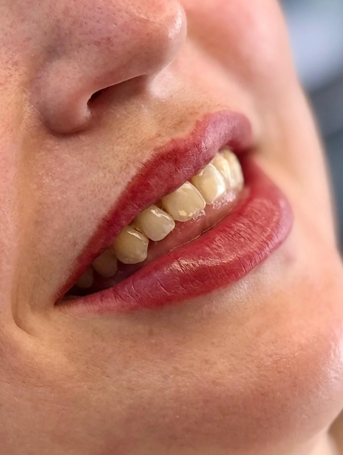 Direct na de behandeling.
Direct na de behandeling is de kleur voller en intenser. Tijdens de genezing verzacht de pigmentatie geleidelijk, waardoor een subtiel en natuurlijk resultaat ontstaat.
