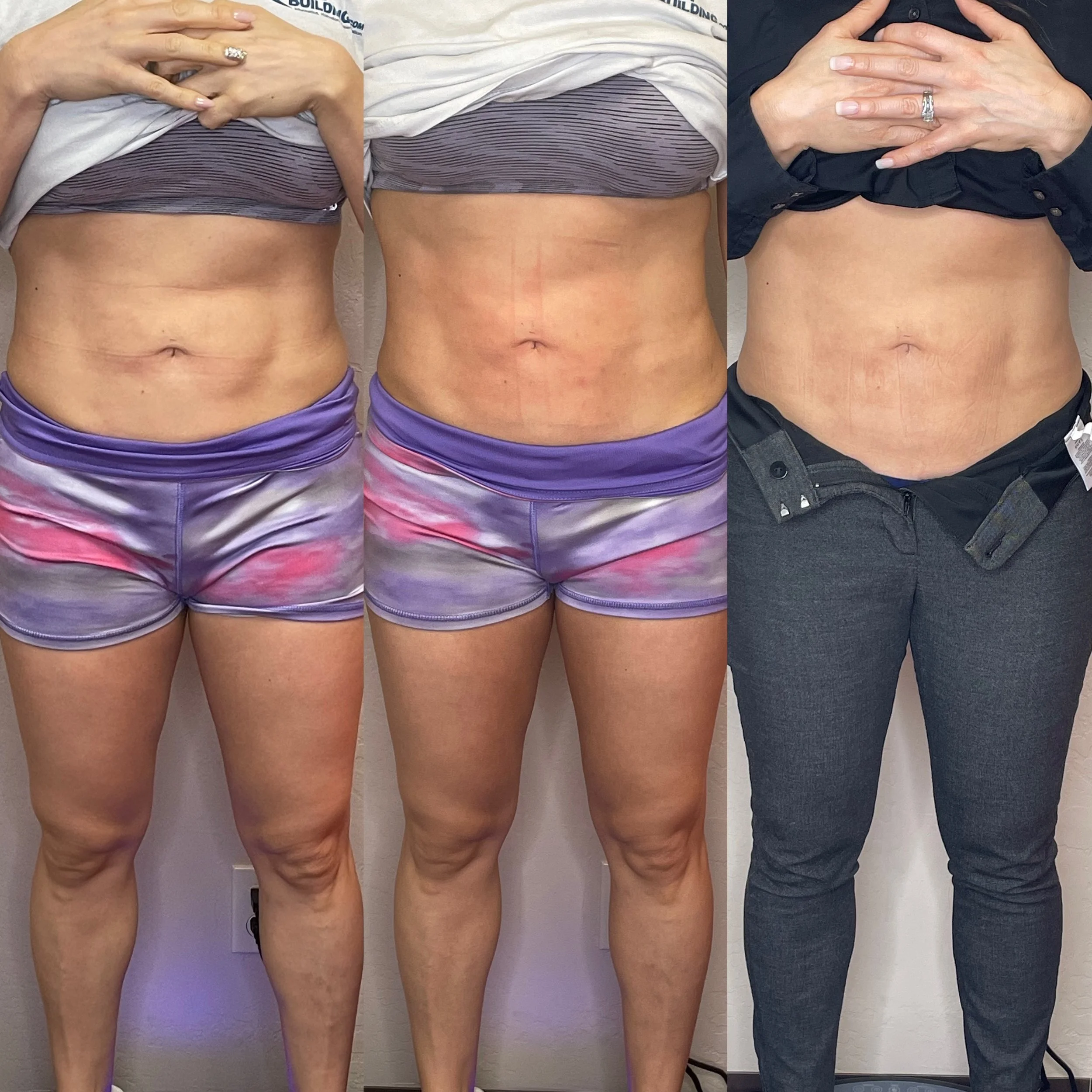Three photos of a person's midsection, showing progress of weight loss or body transformation. The person is lifting their shirt to reveal their abdomen and waist in each photo. The first and second photos show the person in different casual clothing