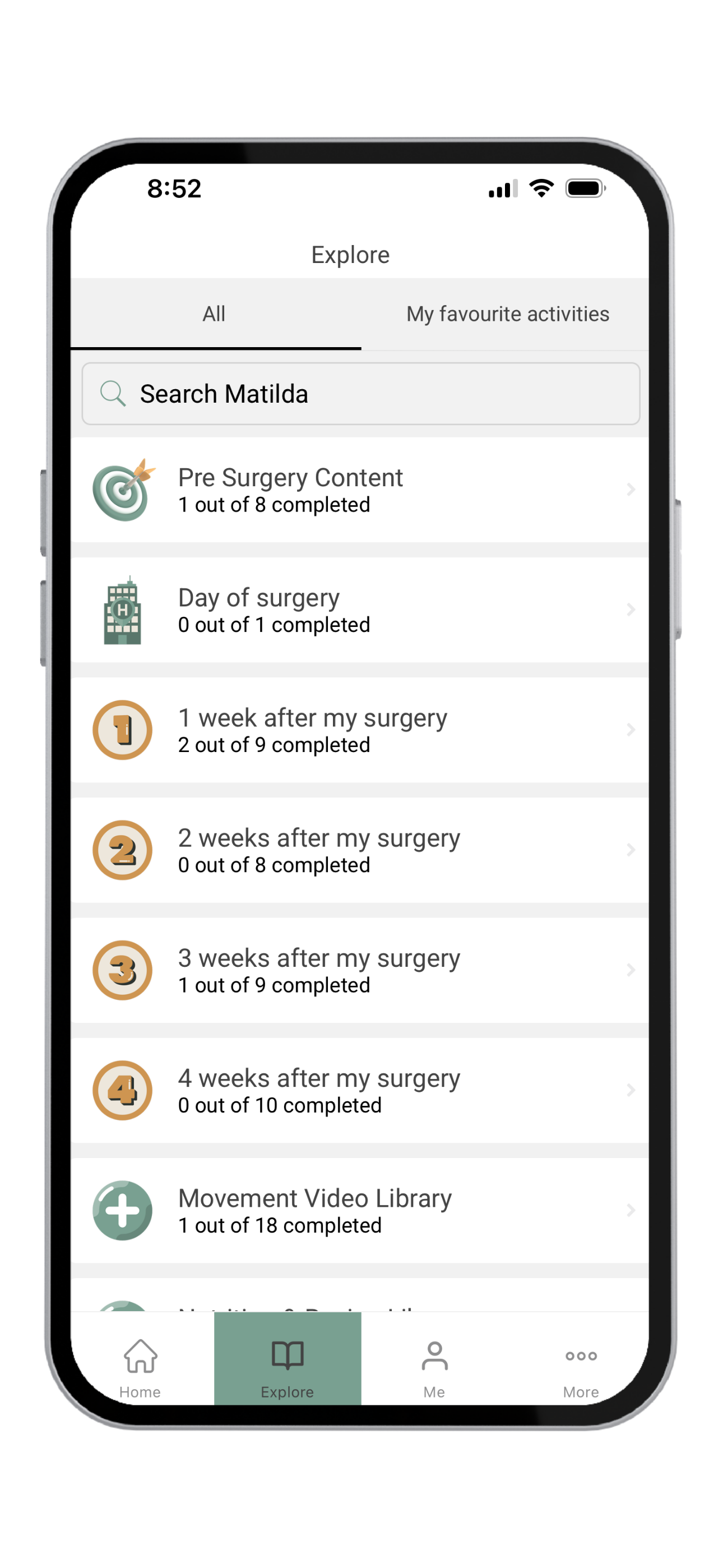 Screenshot of a mobile app displaying a progress tracker with sections for pre-surgery content, surgery day, and post-surgery recovery milestones, including icons and completion updates.