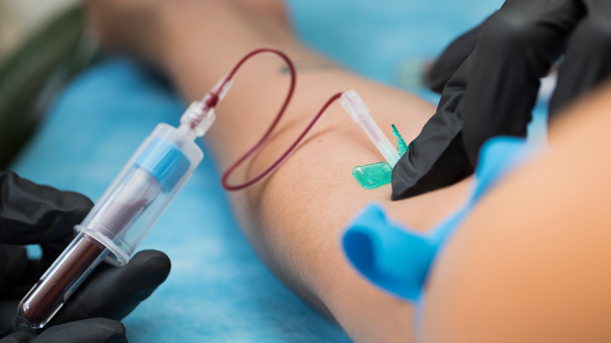 A person is donating blood, with a healthcare worker attaching a blood collection tube to a needle in the person's arm, which is covered with a black glove and a blue drape.