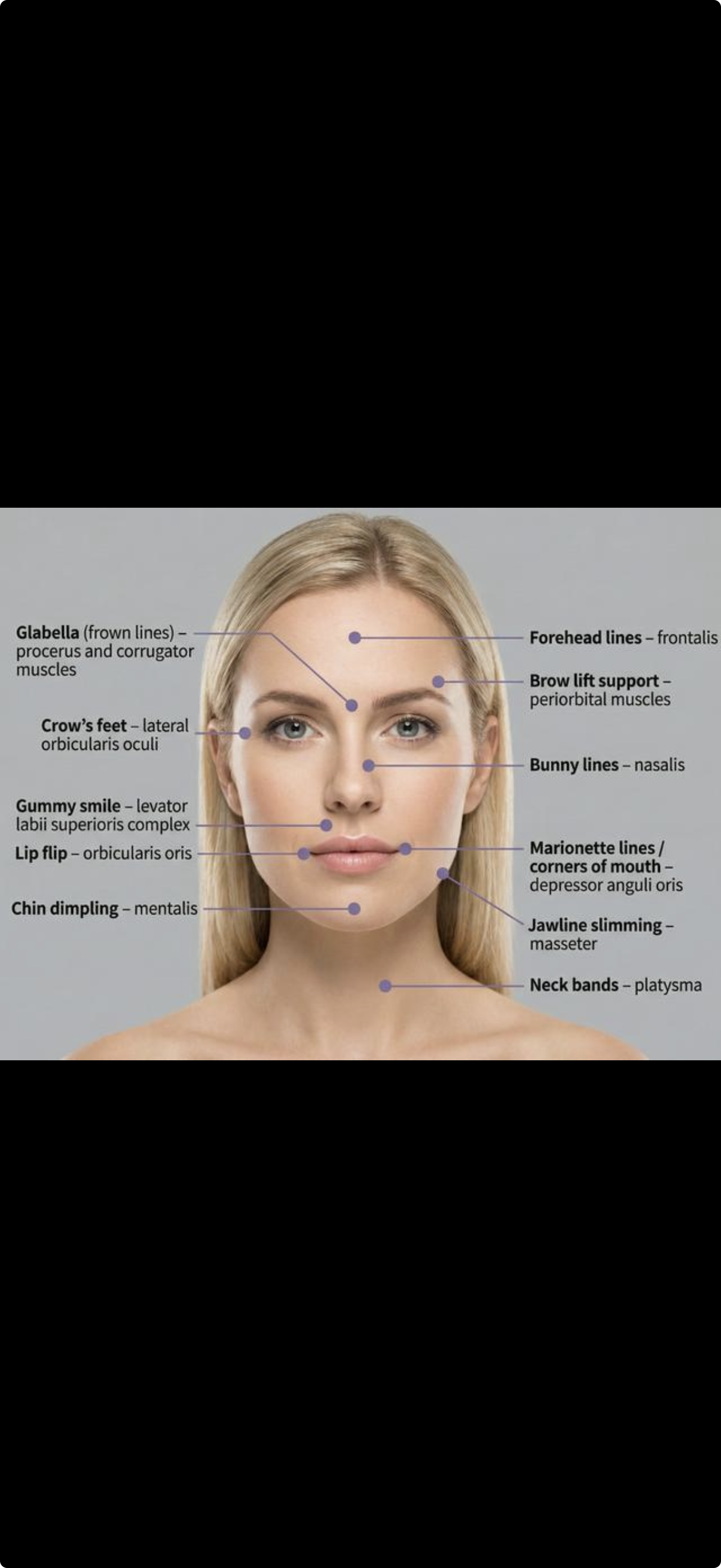 Botox