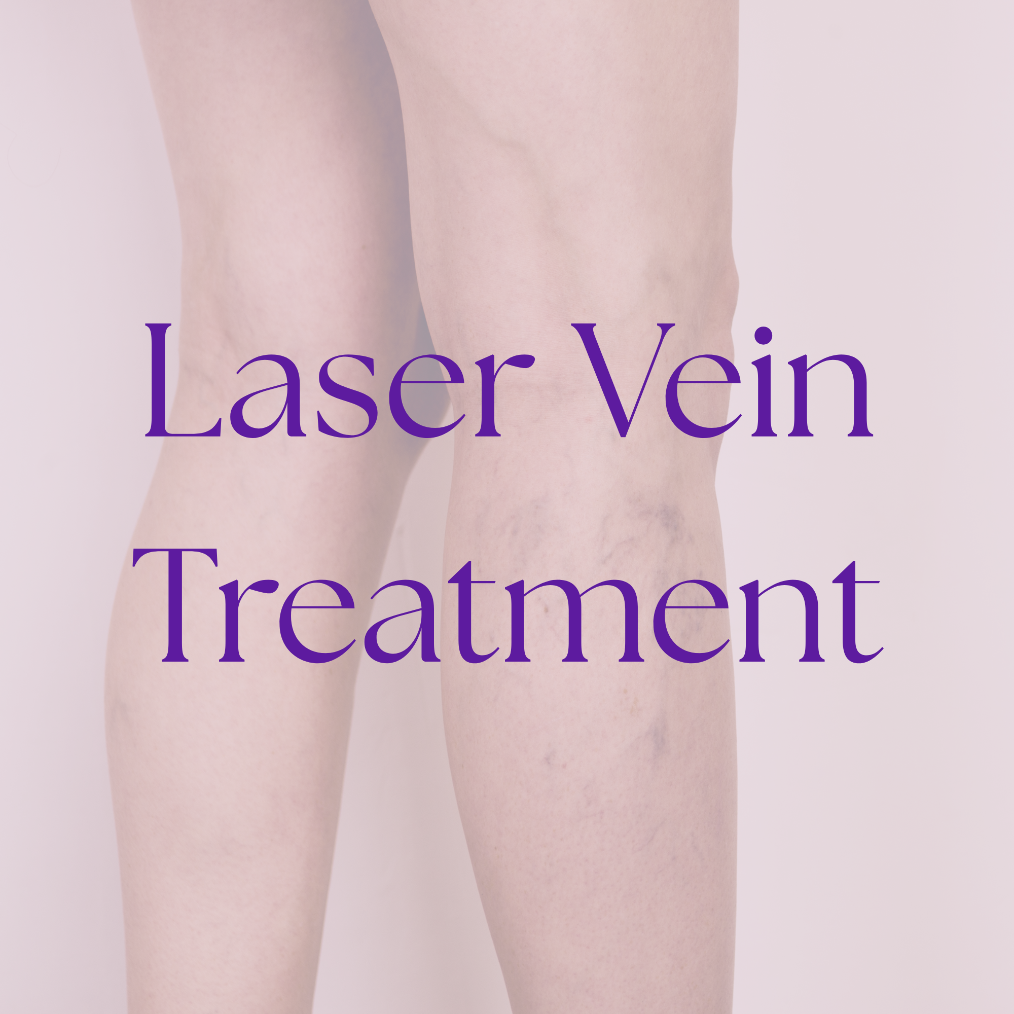 Close-up of a person's thighs with the text 'Laser Vein Treatment' overlaid.
