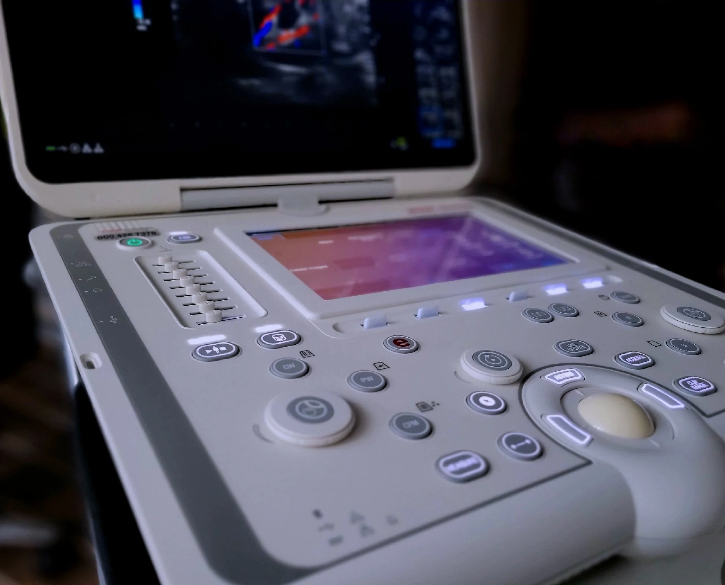 Close-up of medical ultrasound equipment with a laptop screen in the background.