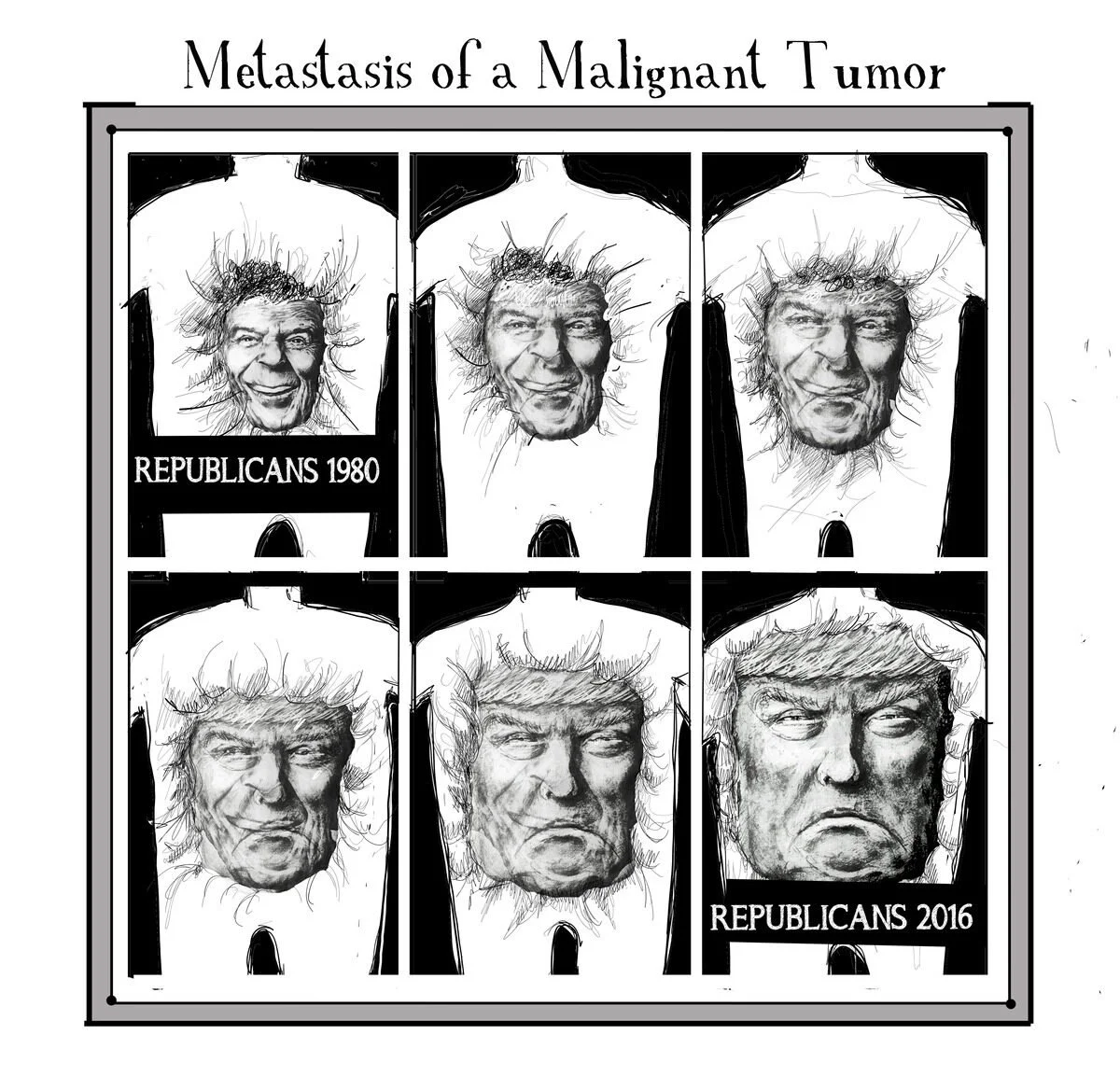 Illustration of six images of a man's face, resembling Donald Trump, with changes over time from 1980 to 2016, labeled 'Metastasis of a Malignant Tumor.' The top row shows three images from 1980, and the bottom row shows three images from 2016, with 