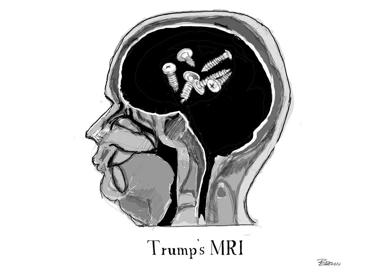 A black-and-white sketch of an MRI scan of President Trump's head, showing screws inside his brain, with the text "Trump's MRI" below.