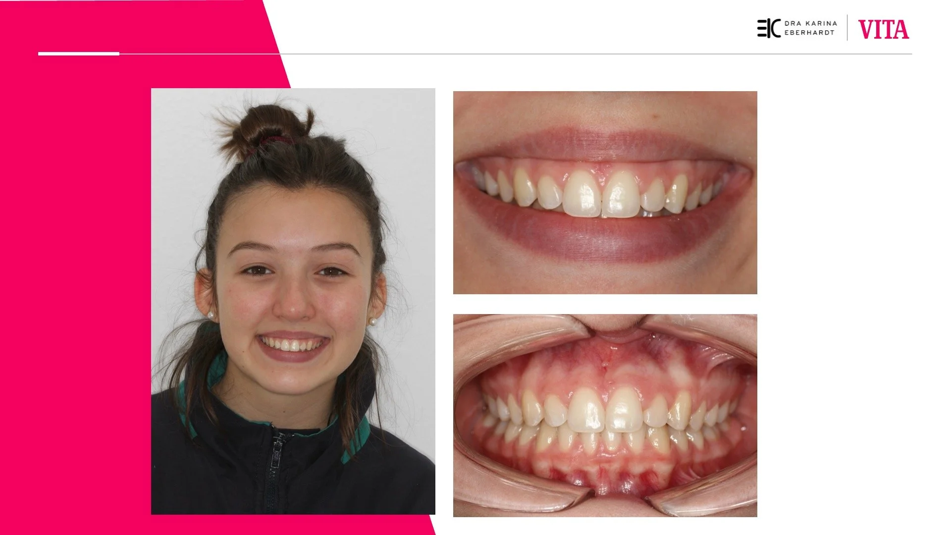 Diapositiva13.jpeg