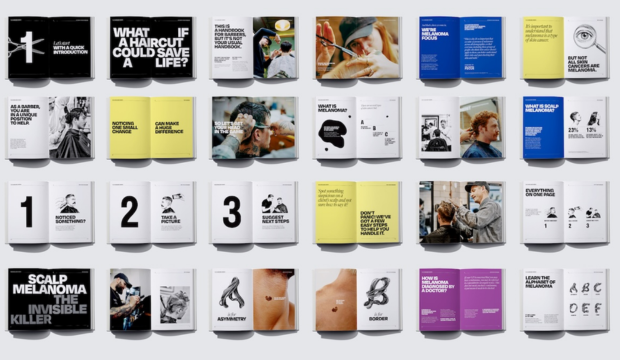 A collection of open books and pamphlets about health, skin, and hair, with various images and text including titles like "Scalp Melanoma: The Invisible Killer" and "What is melanoma?"