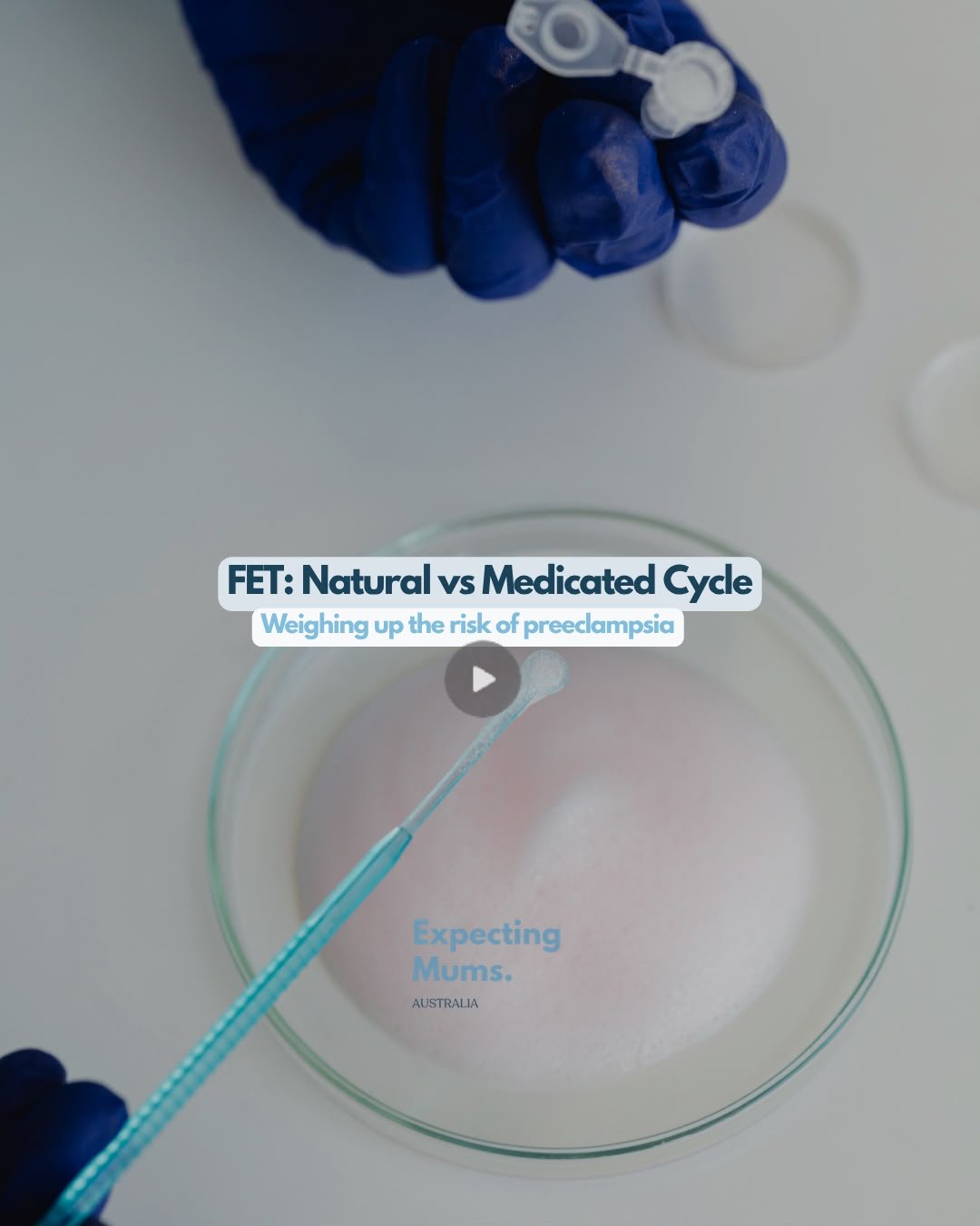 Frozen Embryo Transfer: Natural vs Medicated Cycle | Watch now | Expecting Mums Australia