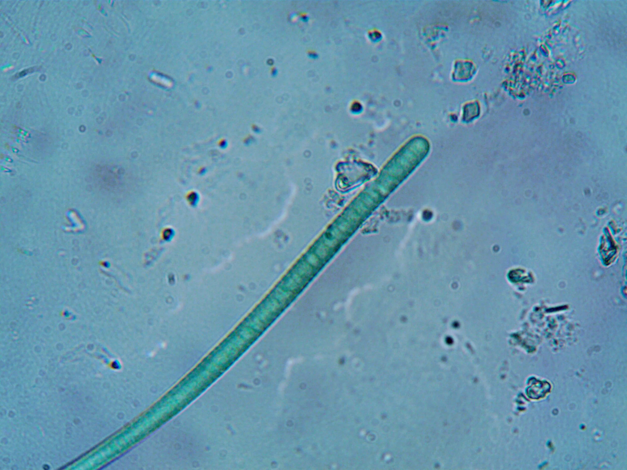 Microscopic view of various microorganisms, including a long, green, filamentous organism and smaller, rounded cells scattered throughout the field.