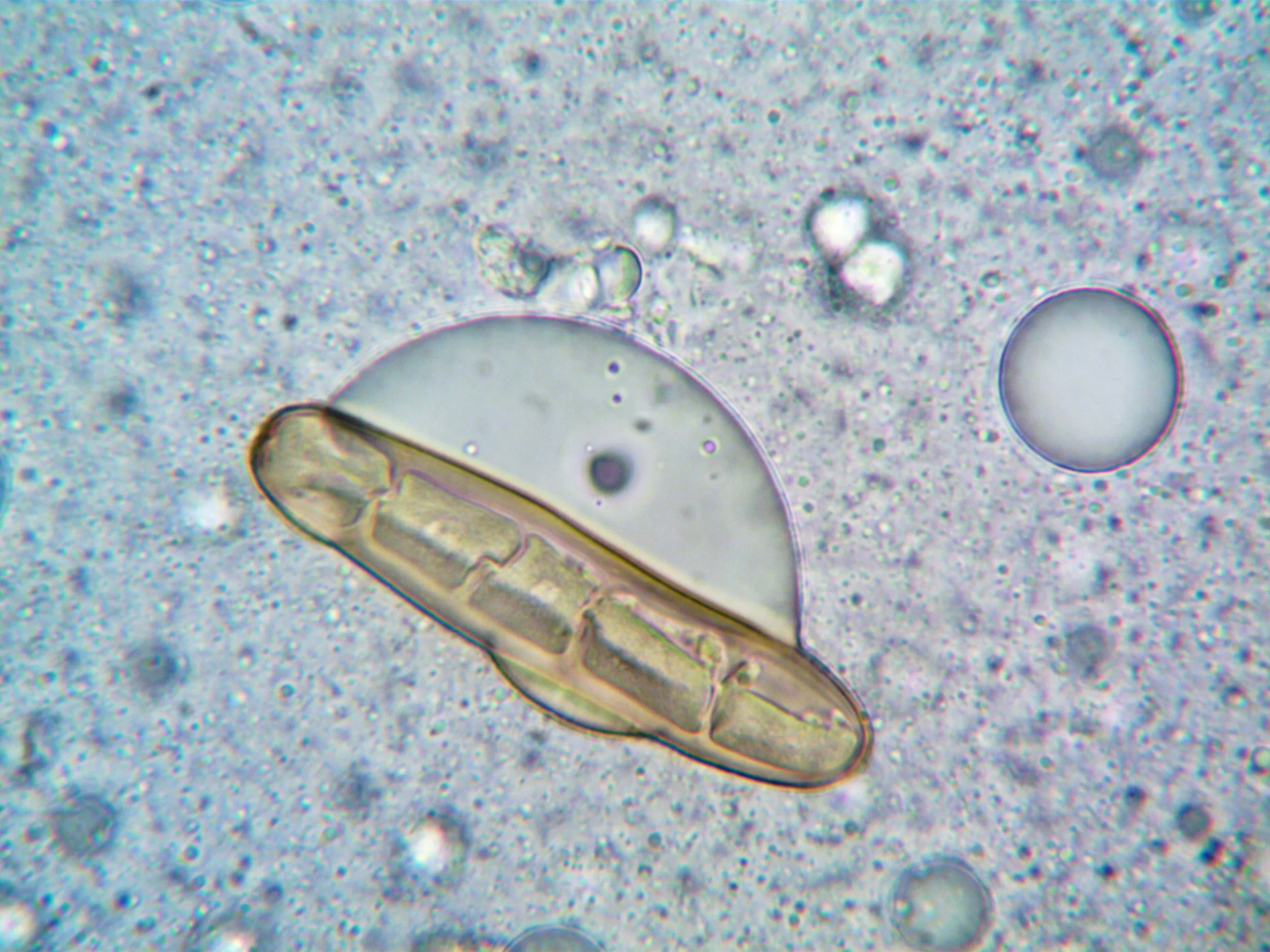 Microscopic view of a single-celled organism or bacteria with internal structures visible, set against a grainy background.