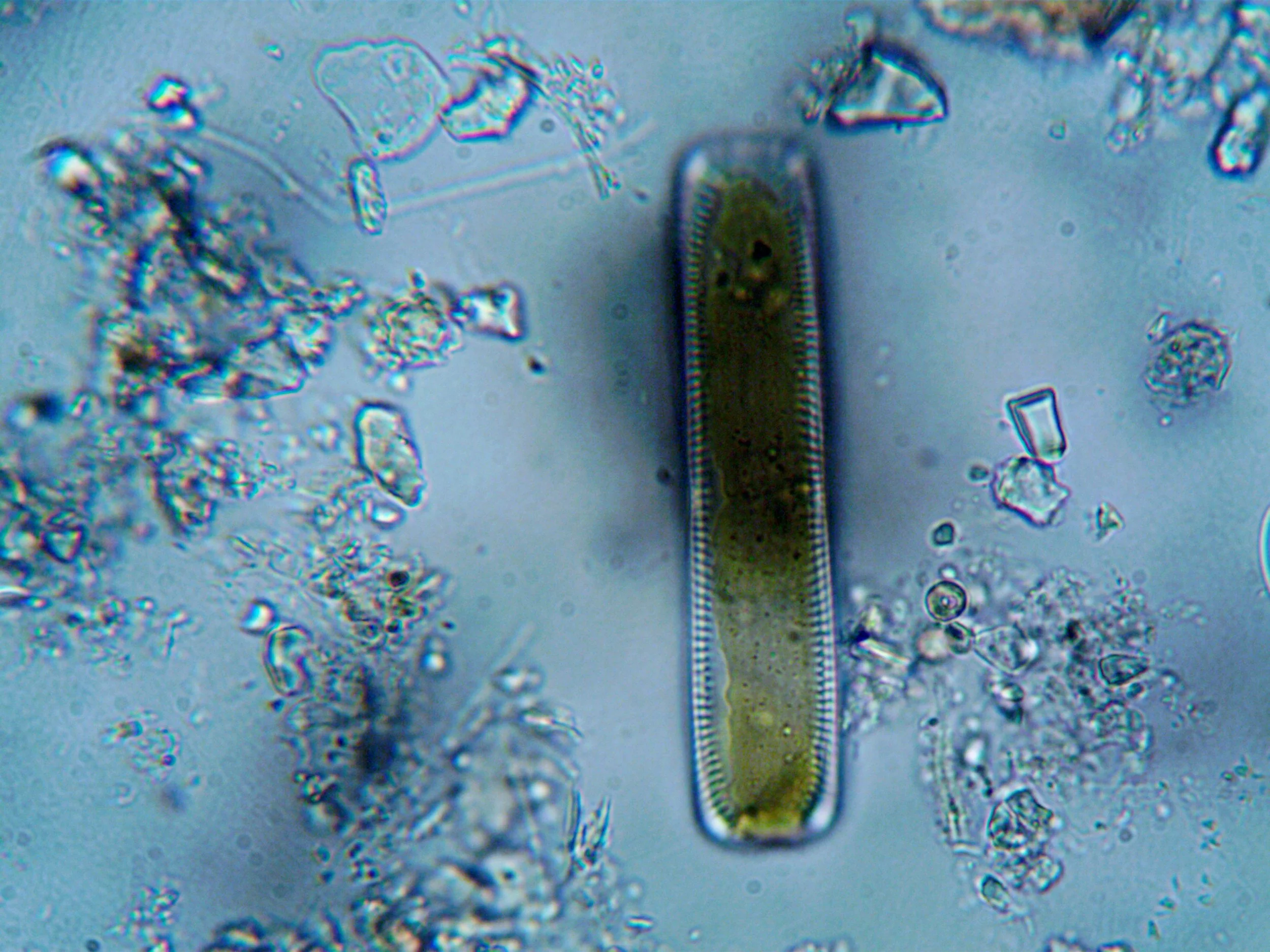 A microscopic view of a green diatom with a long, rectangular silica shell, surrounded by various small, irregularly shaped particles and bubbles.