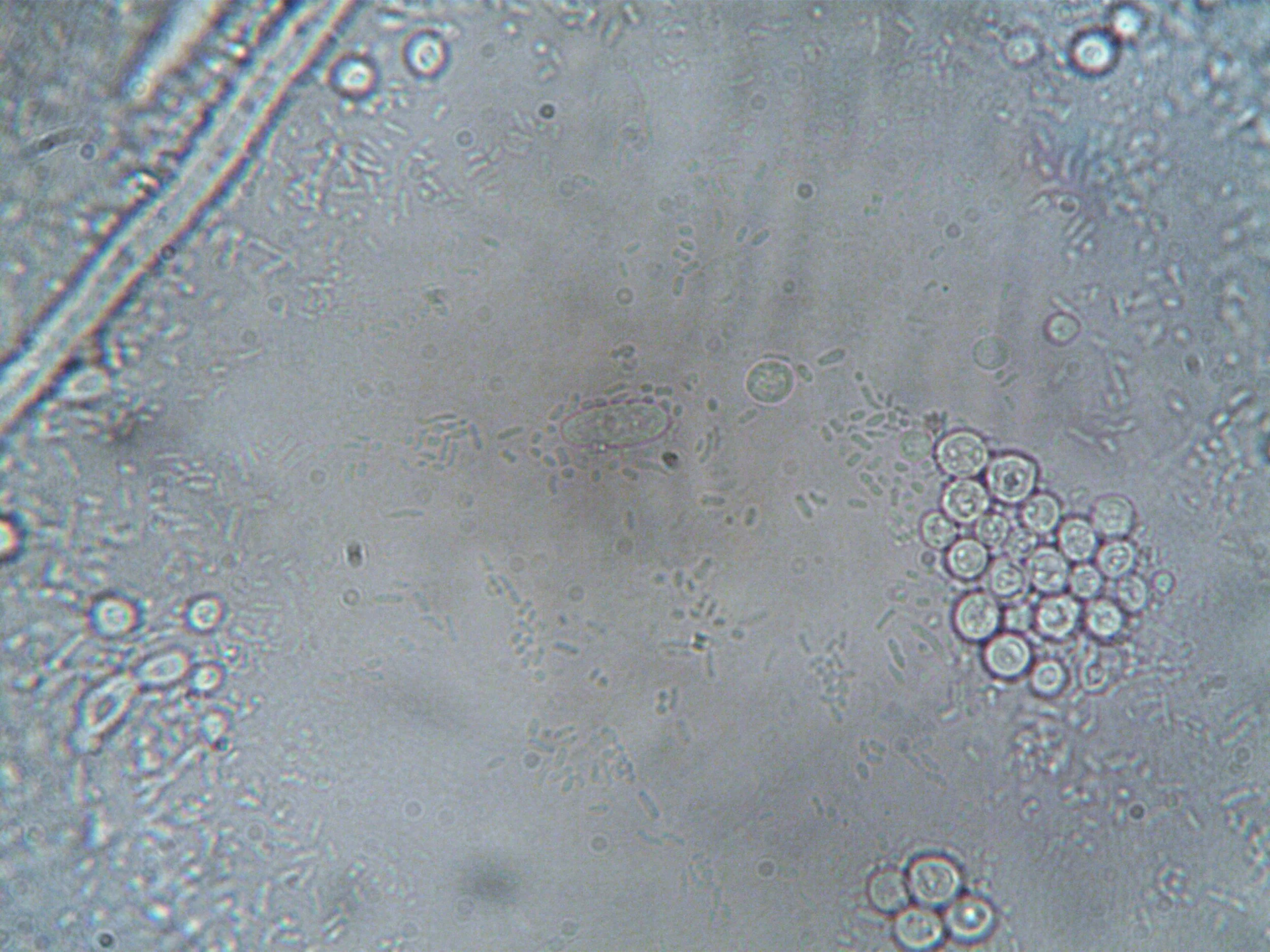 Microscopic view of cells or microorganisms, showing circular and elongated structures.