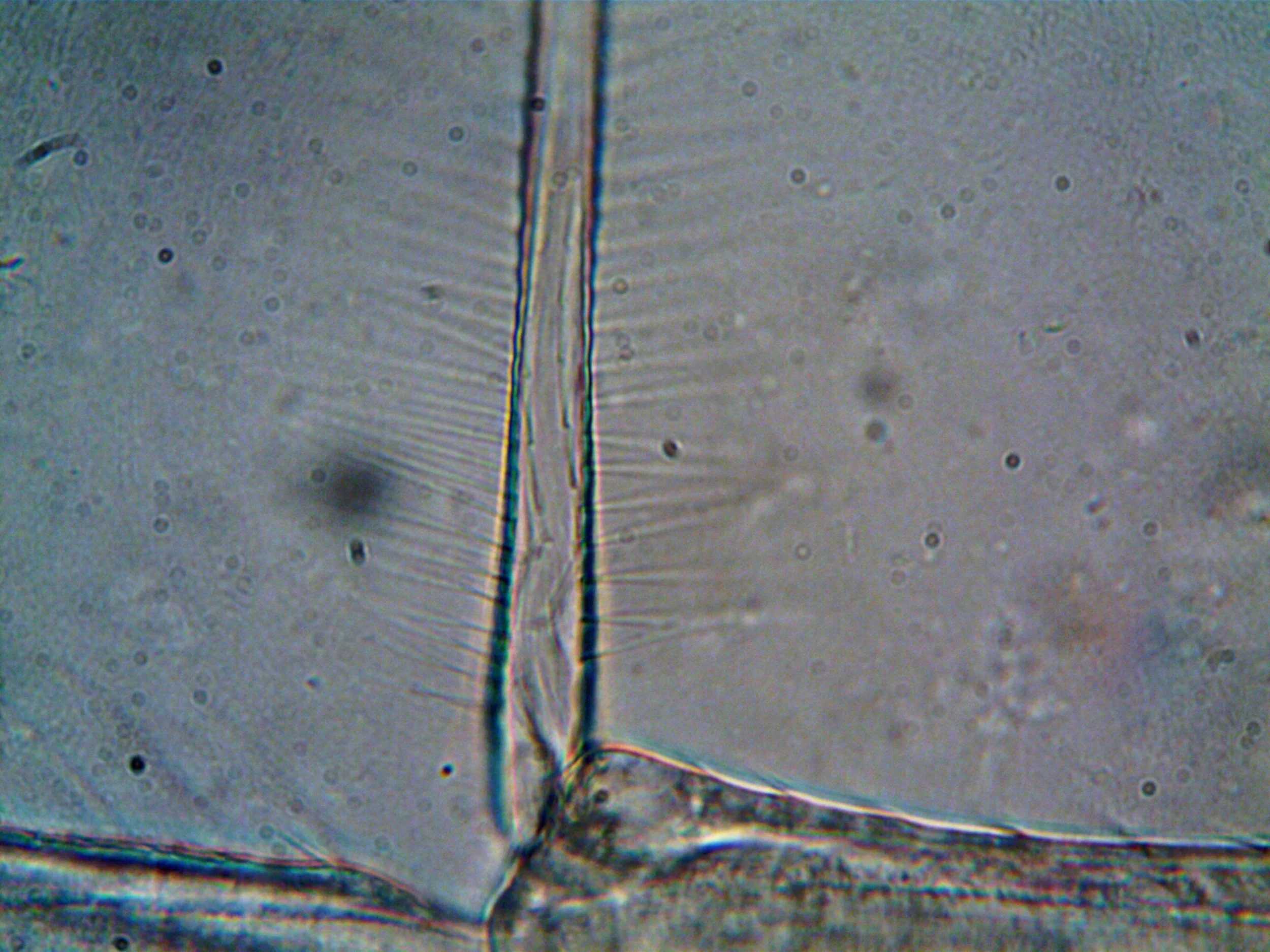 Microscopic view of a hair follicle, showing the hair shaft and surrounding skin tissue with numerous tiny circular structures.