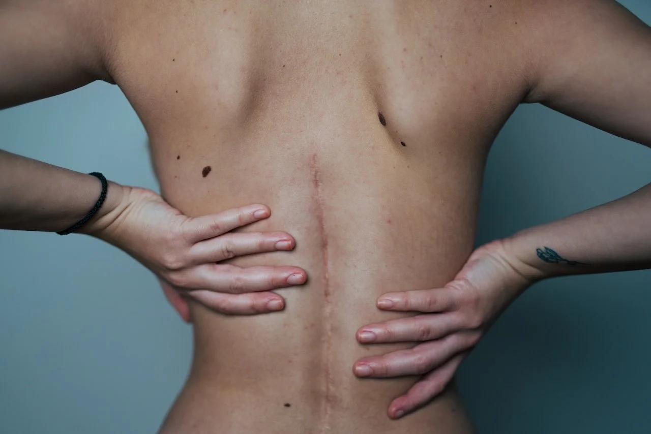 Scar & Fibrosis Therapy by Restorative Rituals Wellness ~ In Home Mobile Services