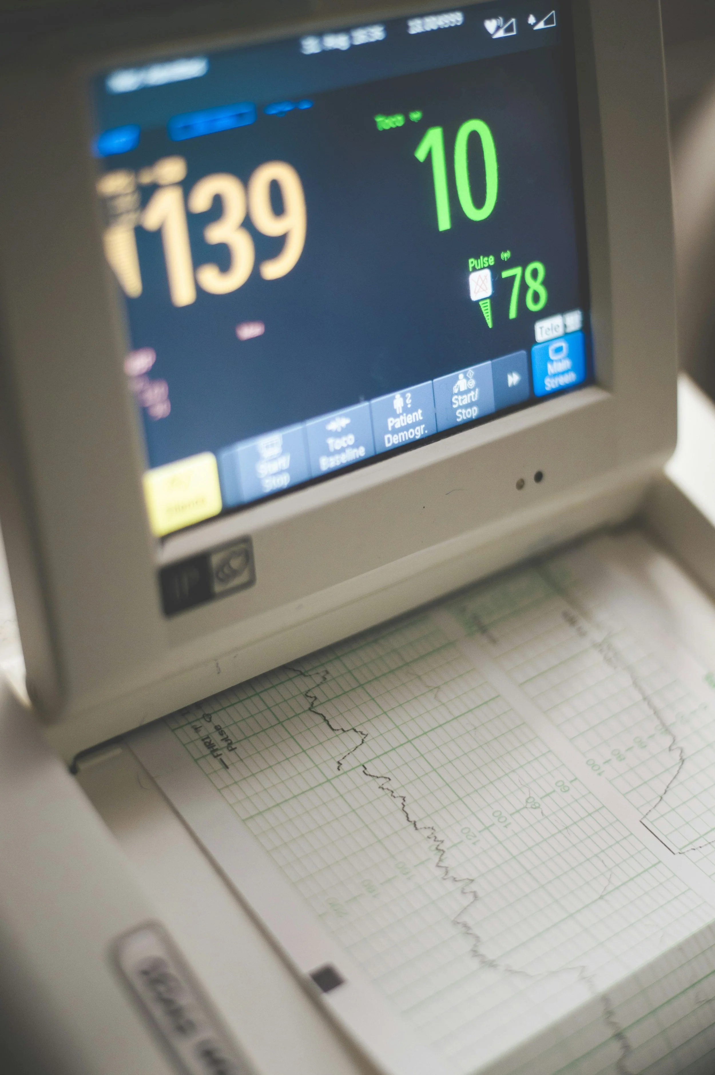 Medical monitor displaying heart rate, oxygen level, and pulse, with a graph on paper beneath it.