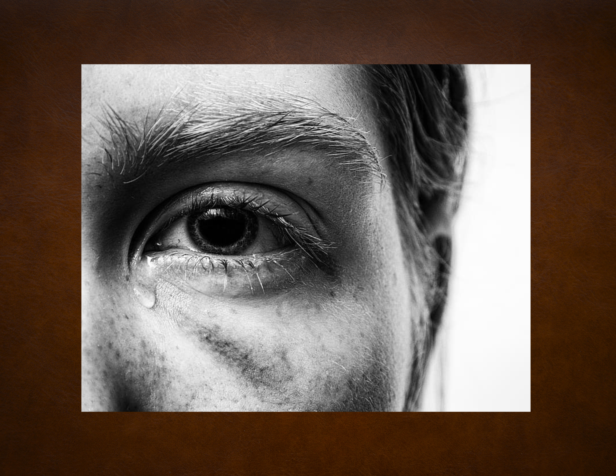 Trauma Recovery