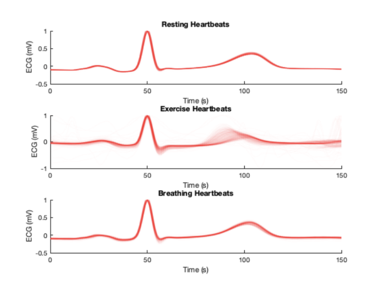 matlab signal processing