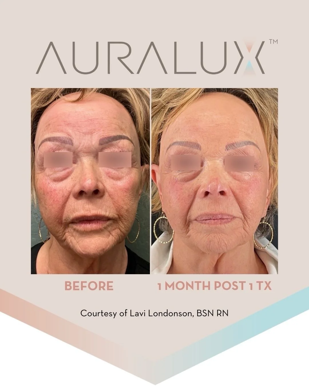 auraluxau_1786348967_3960504420572518235_24115843533.jpg