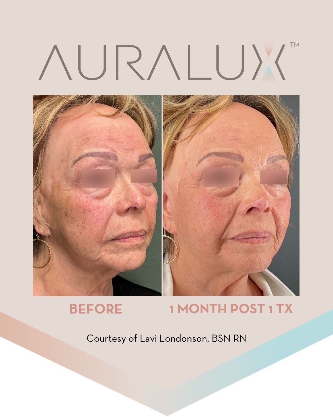auraluxau_1786348967_3960504454714116938_24115843533.jpg