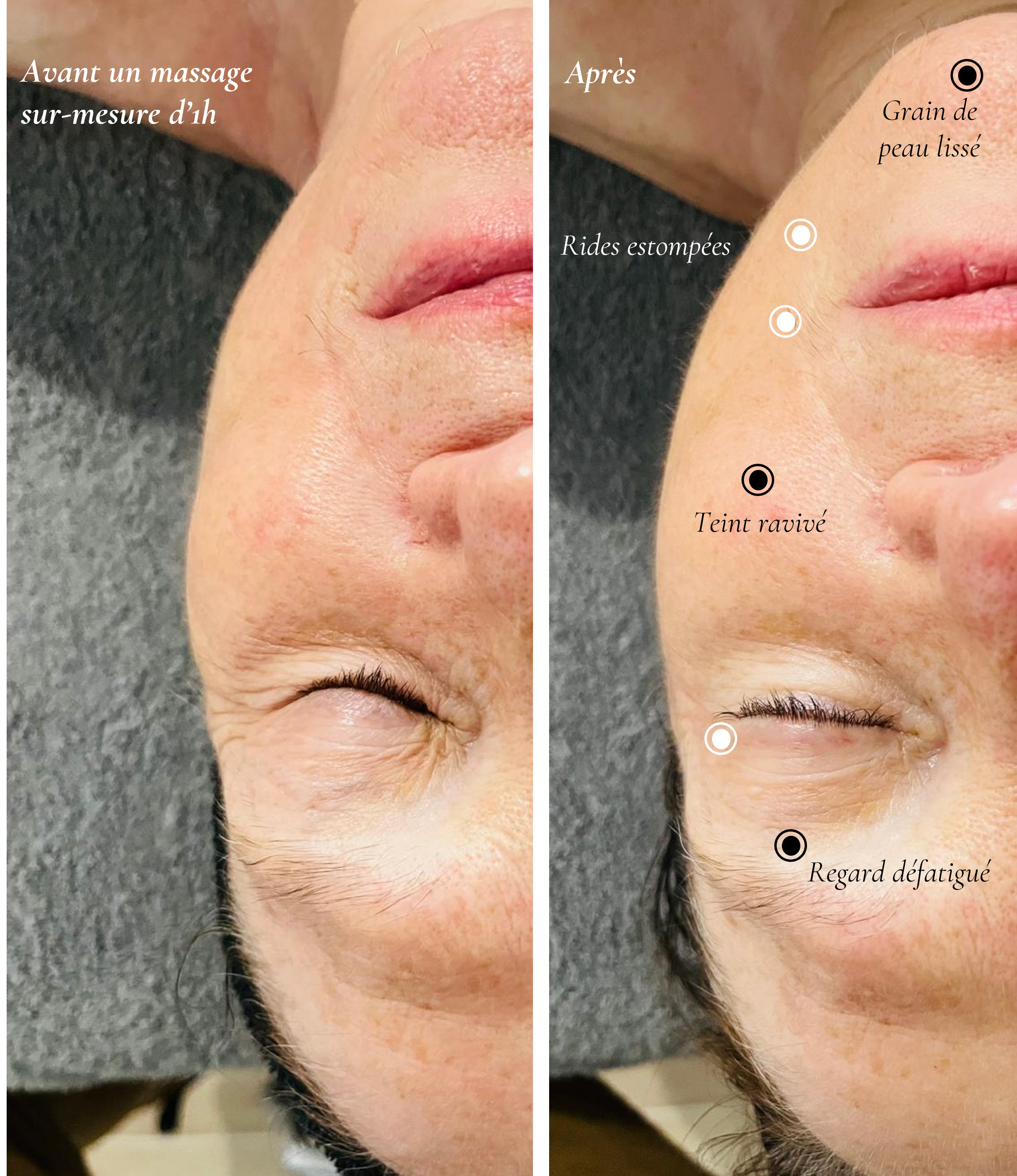 Massage du visage sur-mesure pour un teint éclatant et des rides estompées sur l'ensemble du visage