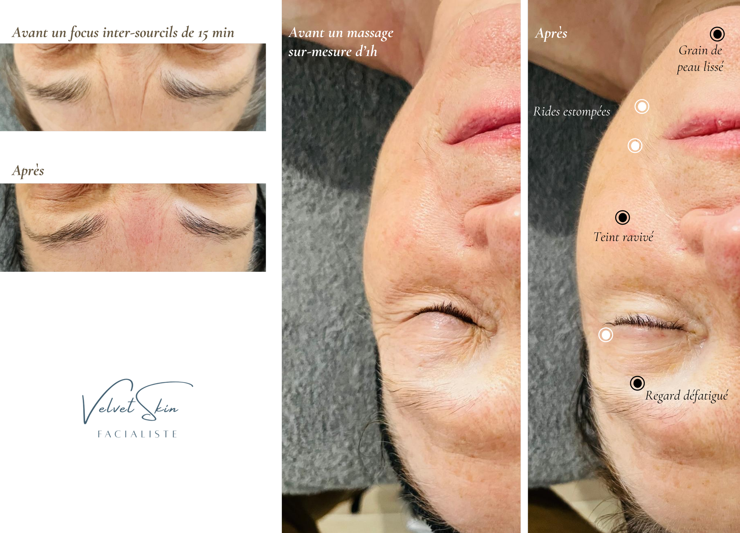 Massage du visage sur-mesure pour un teint éclatant et des rides défroissées