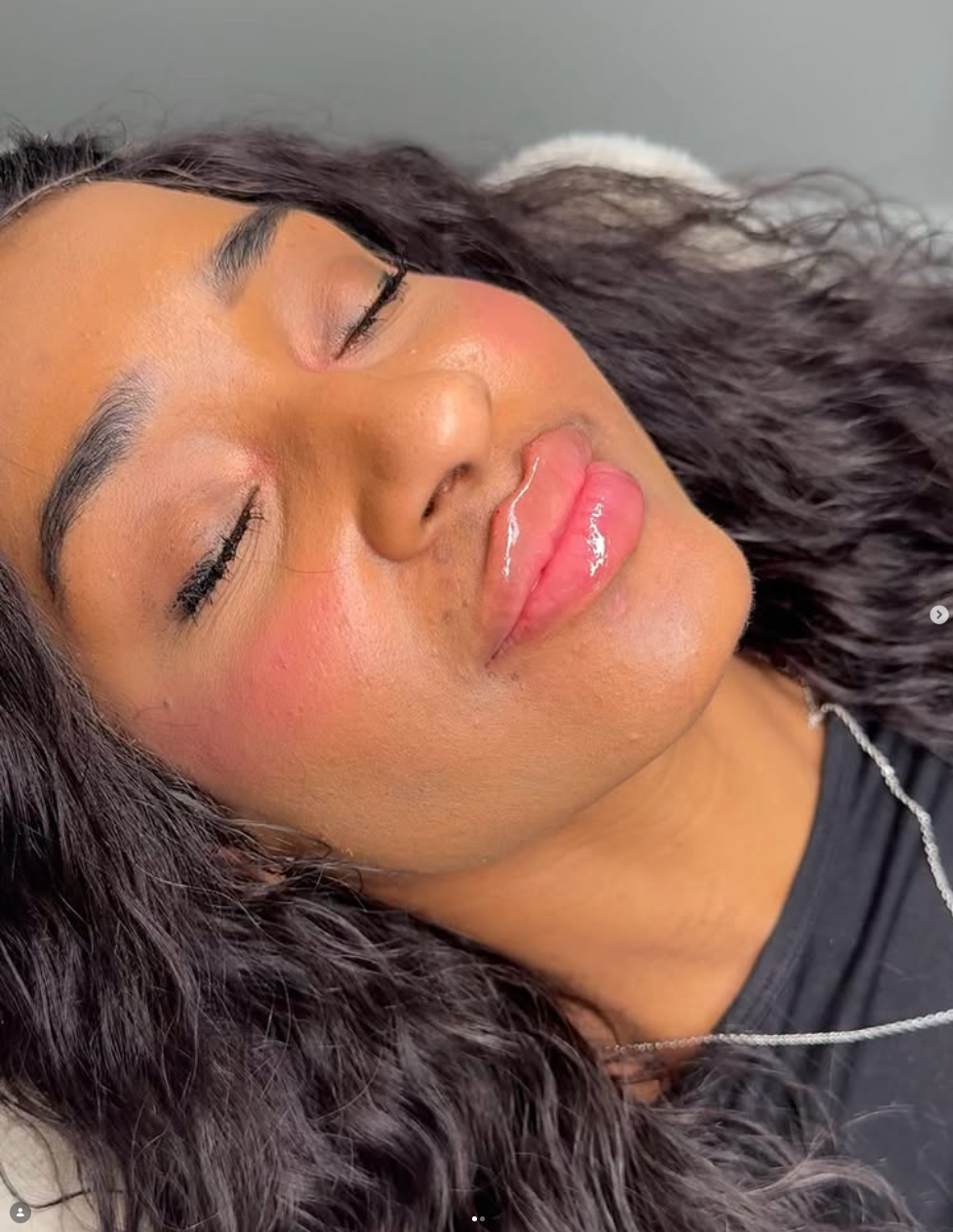 A woman with curly dark hair, her eyes closed, and her face relaxed, showing smooth skin and glossy lips. RUSSIAN LIP FILLER