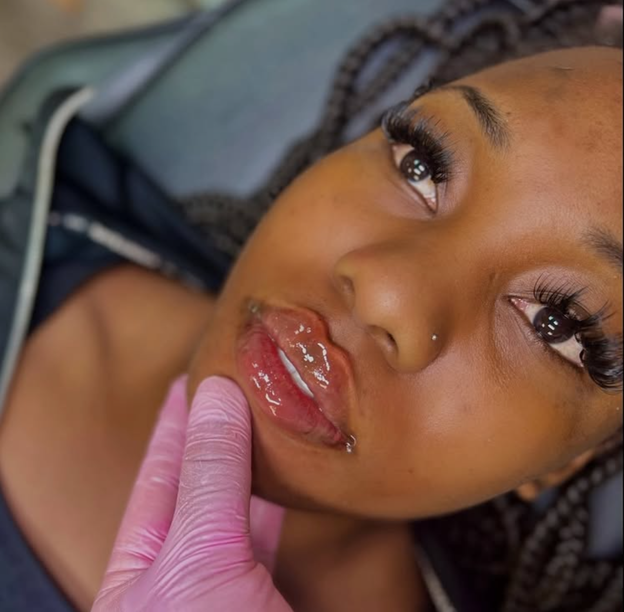  RUSSIAN LIP FILLER A close-up photo of a woman with dark skin and braided hair, lying down, looking up. A person wearing a pink glove is gently touching her lips, which are glossy and slightly parted.