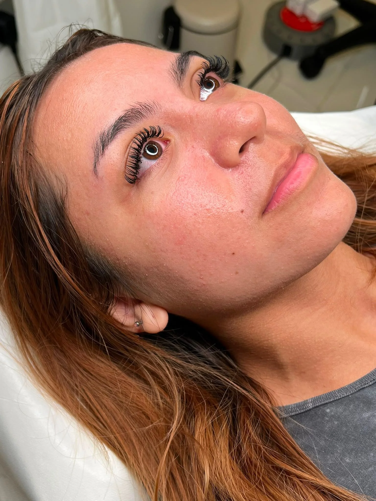 A woman lying on a bed with her head turned to the side, showing her face and long reddish-brown hair, with eyelash extension procedure in a medical setting.
