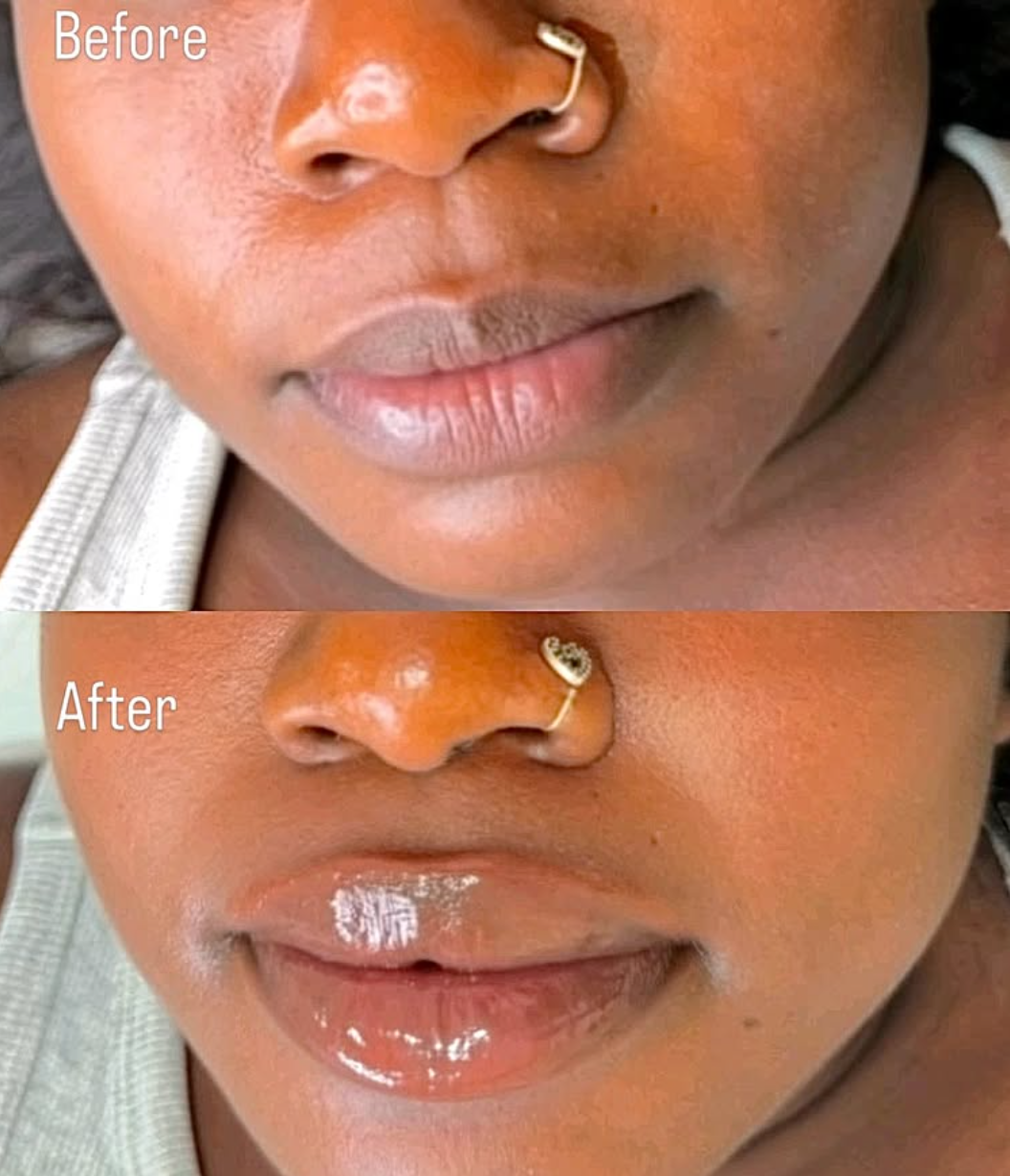 Close-up comparison of a person's lips and nose, showing before and after applying a skincare or lip product. The "before" image shows dry lips, and the "after" image shows shiny, moisturized lips. RUSSIAN LIP FILLER